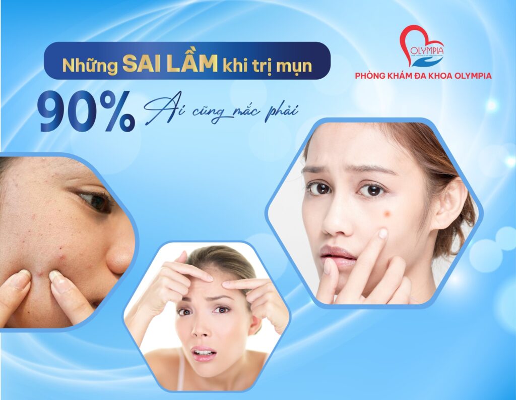 NHỮNG SAI LẦM KHI TRỊ MỤN - 90% AI CŨNG MẮC PHẢI - olympia nha trang