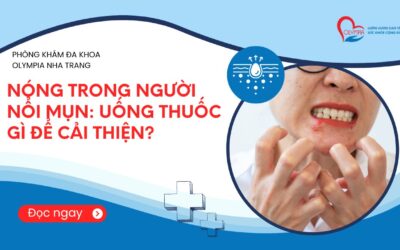 Nóng trong người nổi mụn: Uống gì để cải thiện?