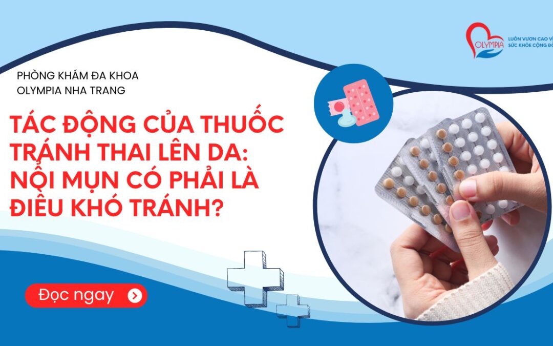 Tác động của thuốc tránh thai lên da: Nổi mụn có phải là điều khó tránh?