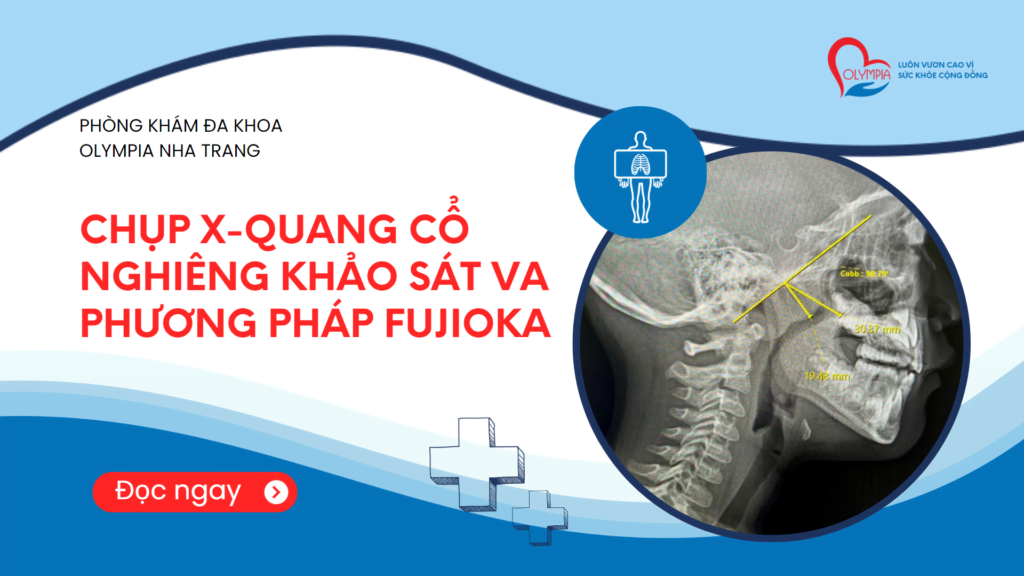 CHỤP X-QUANG CỔ NGHIÊNG KHẢO SÁT VA PHƯƠNG PHÁP FUJIOKA - phòng khám olympia