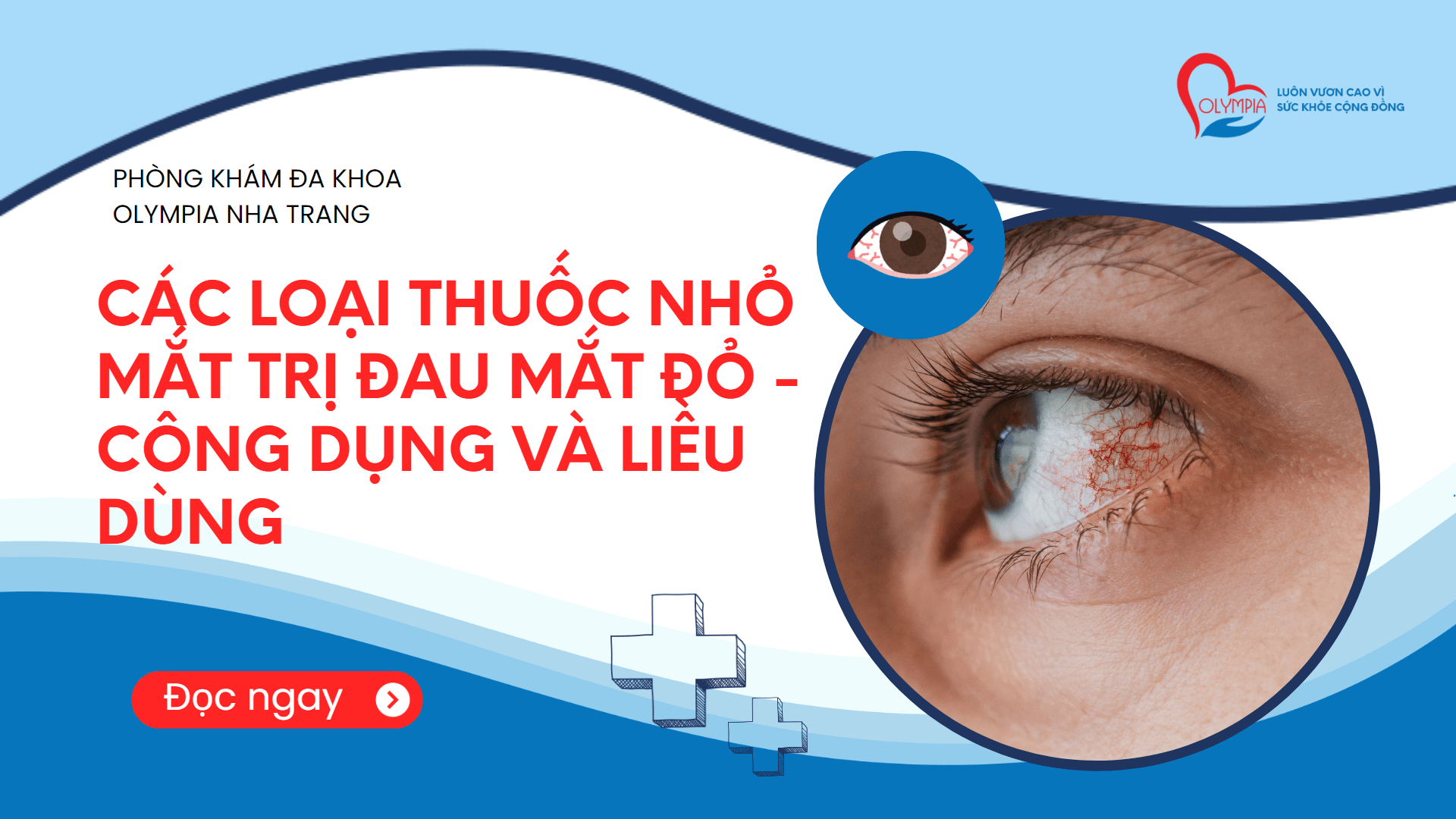 Các loại thuốc nhỏ mắt trị đau mắt đỏ - công dụng và liều dùng - phòng khám đa khoa olympia nha trang