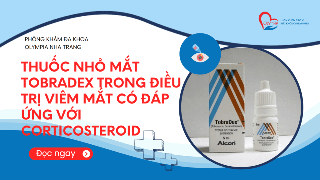 Thuốc Nhỏ Mắt TobraDex Trong Điều Trị Viêm Mắt Có Đáp Ứng Với Corticosteroid - olympia nha trang