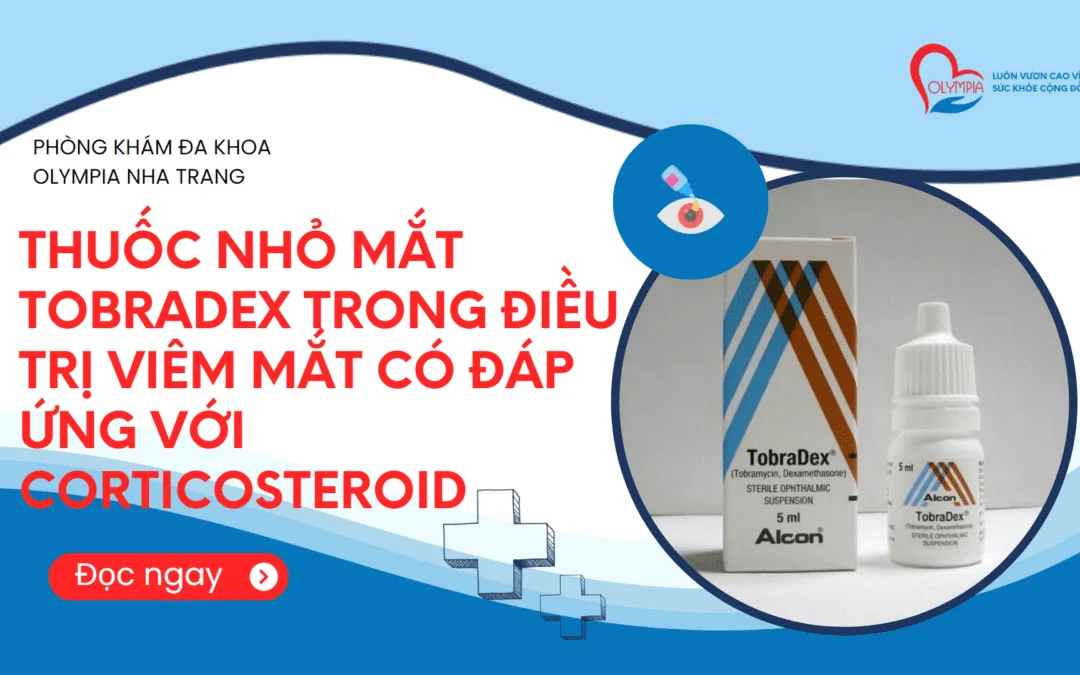 Các câu hỏi thường gặp về Tobradex