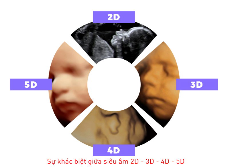 Siêu âm thai Sự khác nhau giữa siêu âm 3D, 4D và 5D hinh anh - phong kham da khoa olympia