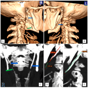 Hình 7. Chụp CT scan vùng cổ.