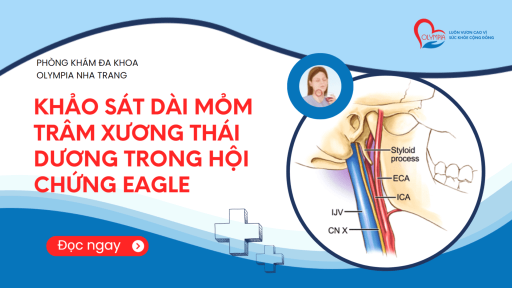 KHẢO SÁT DÀI MỎM TRÂM XƯƠNG THÁI DƯƠNG TRONG HỘI CHỨNG EAGLE - phòng khám đa khoa olympia