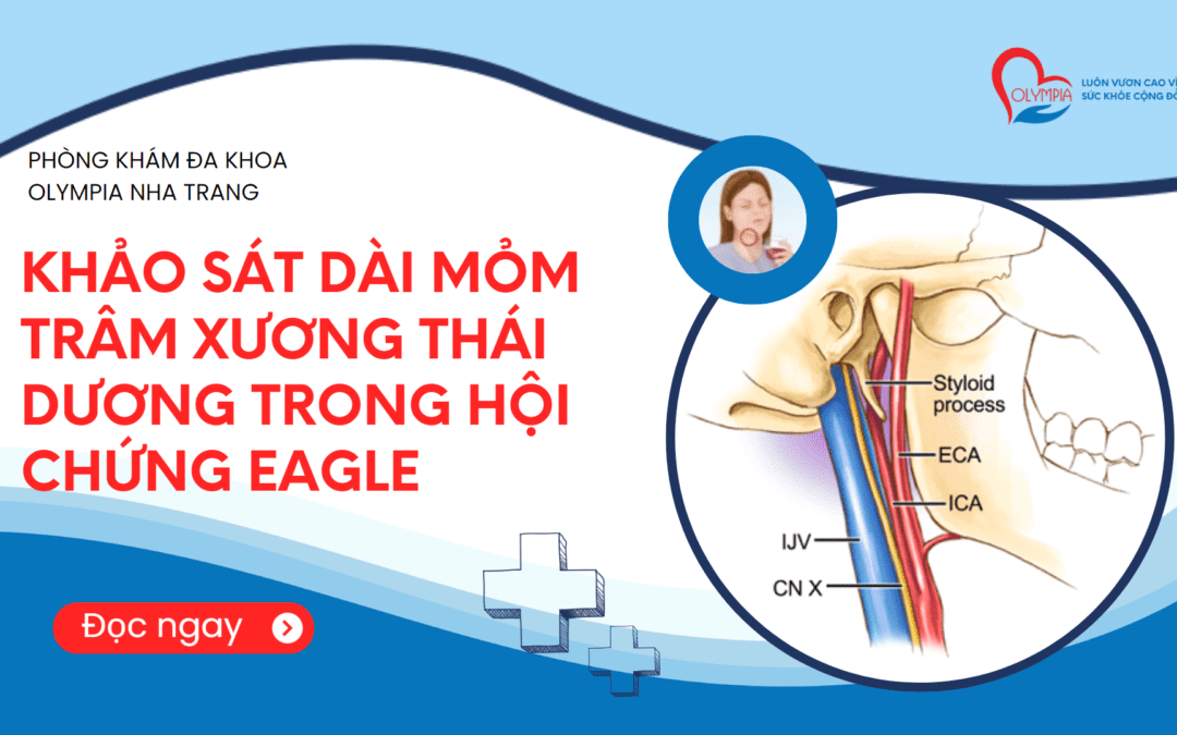 KHẢO SÁT DÀI MỎM TRÂM XƯƠNG THÁI DƯƠNG TRONG HỘI CHỨNG EAGLE