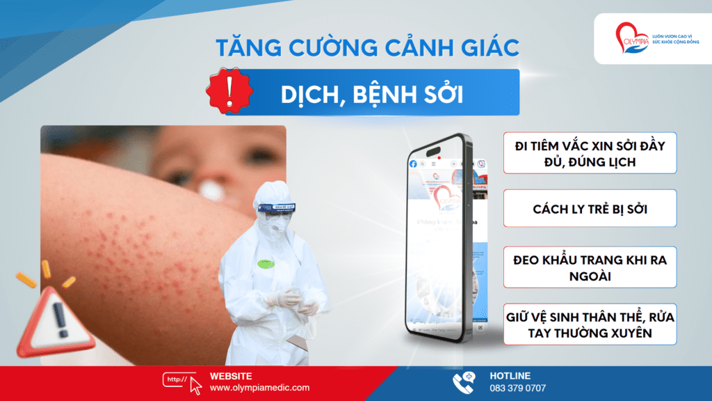 tăng cường cảnh giác dịch bệnh sởi tại phòng khám đa khoa olympia nha trang