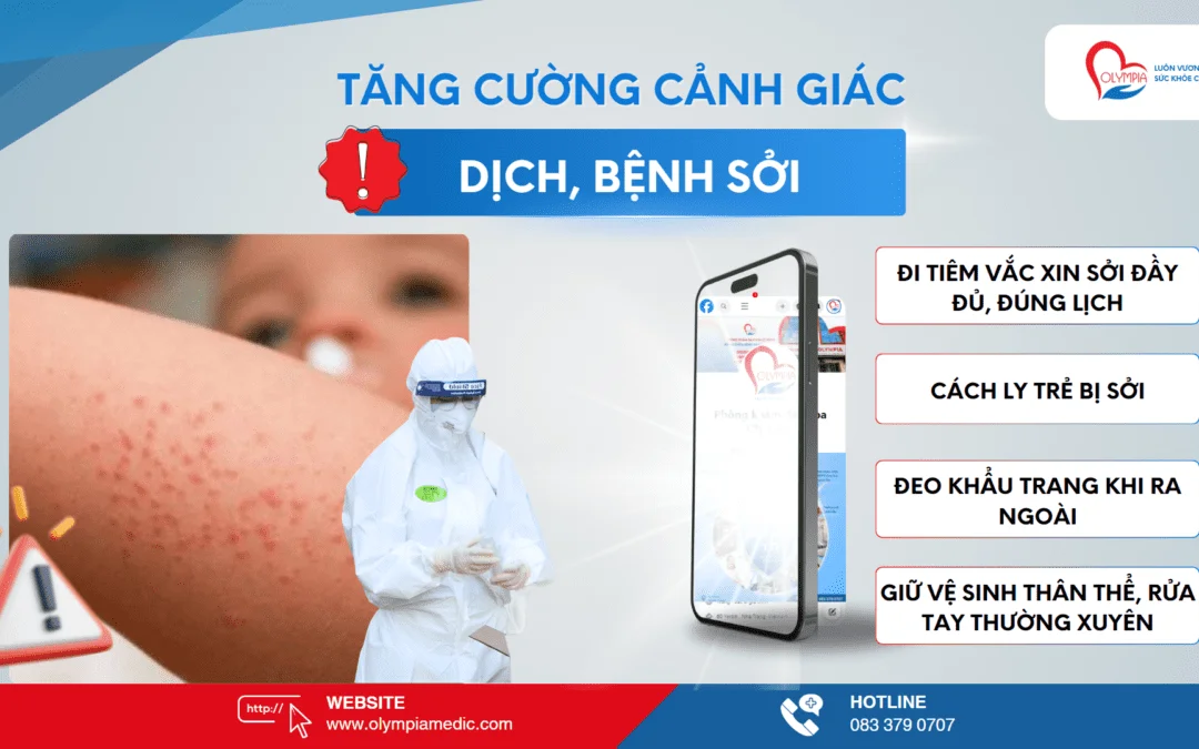 TP.HCM Chính Thức Công Bố Dịch Sởi – Những Điều Phụ Huynh Cần Biết