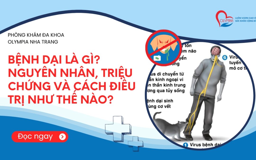 Bệnh dại là gì? Nguyên nhân, triệu chứng và cách điều trị như thế nào?