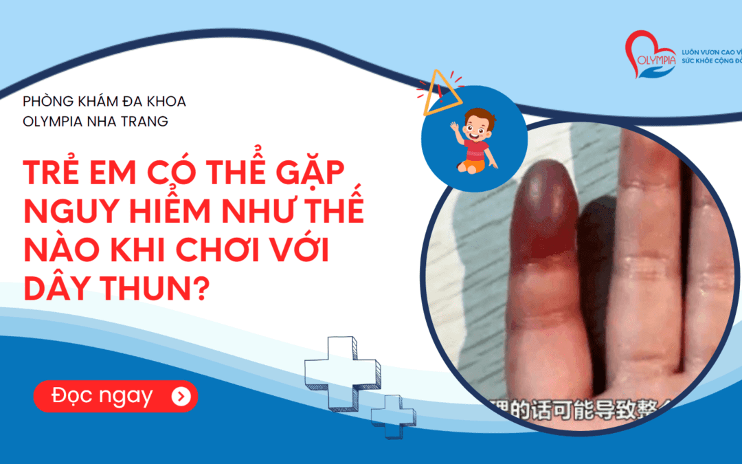 Trẻ Em Có Thể Gặp Nguy Hiểm Như Thế Nào Khi Chơi Với Dây Thun?