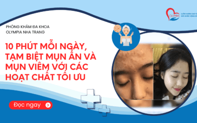 10 Phút Mỗi Ngày, Tạm Biệt Mụn Ẩn Và Mụn Viêm Với Các Hoạt Chất Tối Ưu