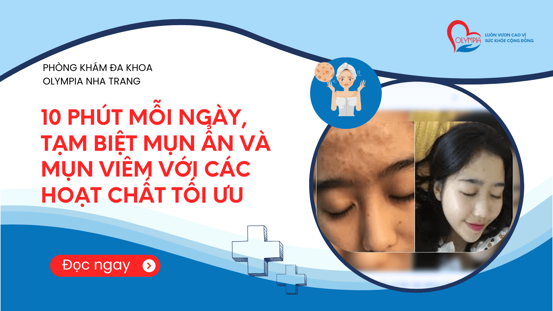 10 Phút Mỗi Ngày, Tạm Biệt Mụn Ẩn Và Mụn Viêm Với Các Hoạt Chất Tối Ưu - phòng khám đa khoa olympia