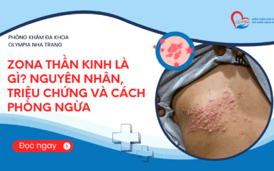 Zona Thần Kinh Là Gì? Nguyên Nhân, Triệu Chứng Và Cách Phòng Ngừa