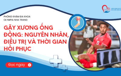 Gãy Xương Ống Đồng Là Gì? Nguyên Nhân, Điều Trị và Thời Gian Hồi Phục
