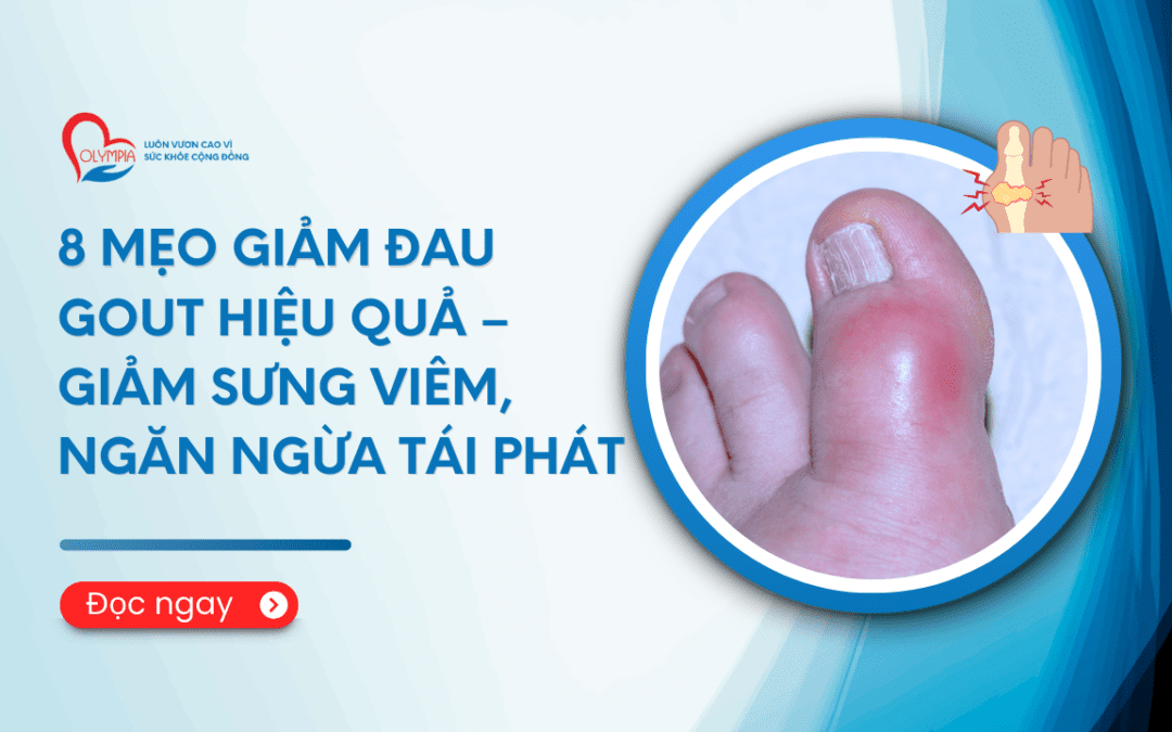 8 Mẹo Giảm Đau Gout Hiệu Quả – Giảm Sưng Viêm, Ngăn Ngừa Tái Phát phòng khám đa khoa olympia