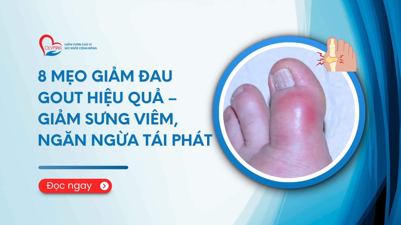 8 Mẹo Giảm Đau Gout Hiệu Quả – Giảm Sưng Viêm, Ngăn Ngừa Tái Phát phòng khám đa khoa olympia