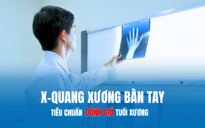 DẬY THÌ SỚM VÀ VAI TRÒ CỦA X-QUANG XƯƠNG BÀN TAY TRONG CHẨN ĐOÁN