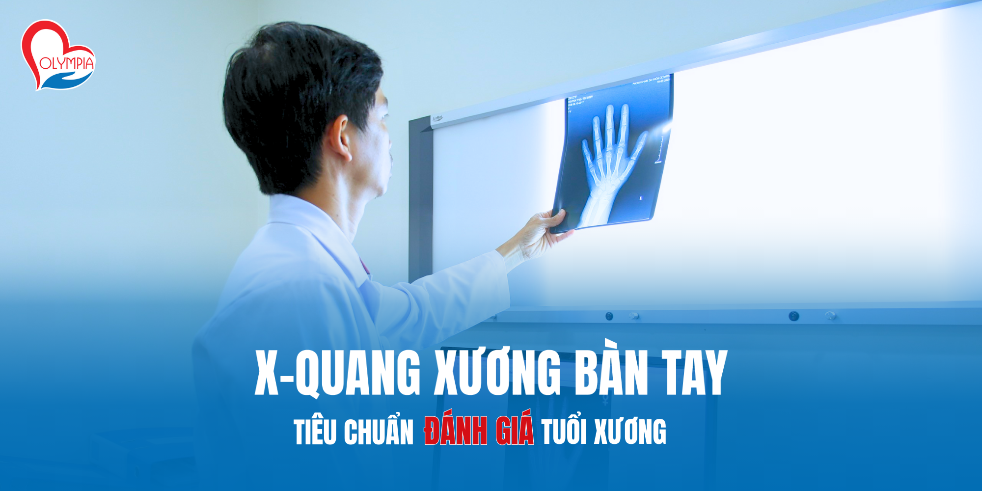 x quang xương bàn tay - tiêu chuẩn đánh giá tuổi xương - phòng khám đa khoa olympia
