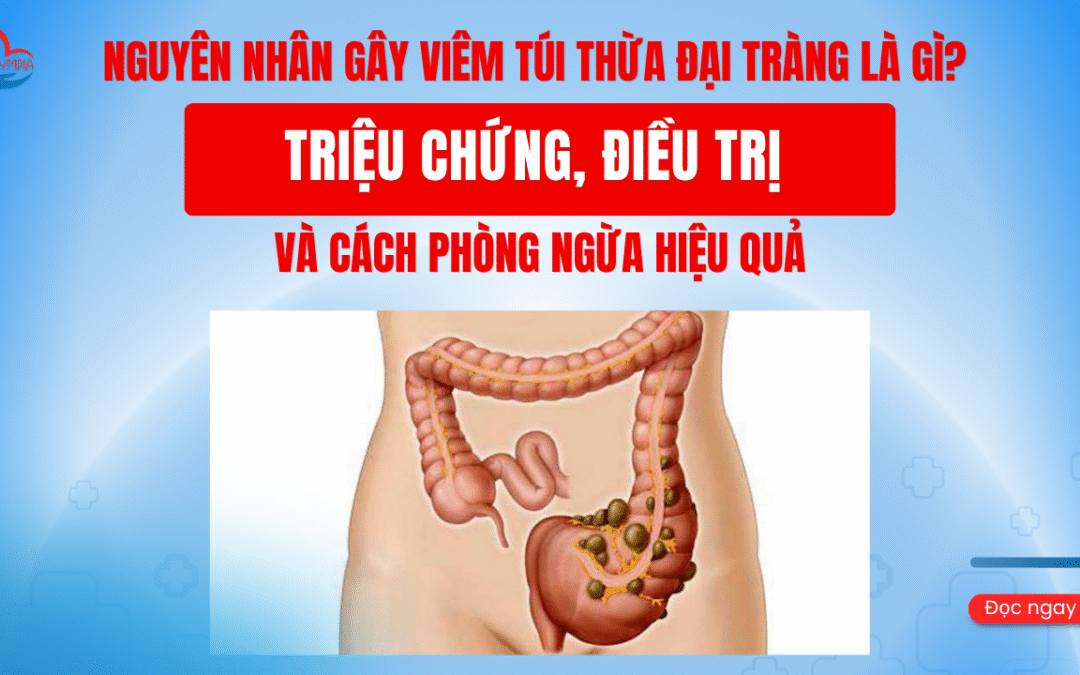 NGUYÊN NHÂN GÂY VIÊM TÚI THỪA ĐẠI TRÀNG LÀ GÌ? TRIỆU CHỨNG, ĐIỀU TRỊ VÀ CÁCH PHÒNG NGỪA HIỆU QUẢ