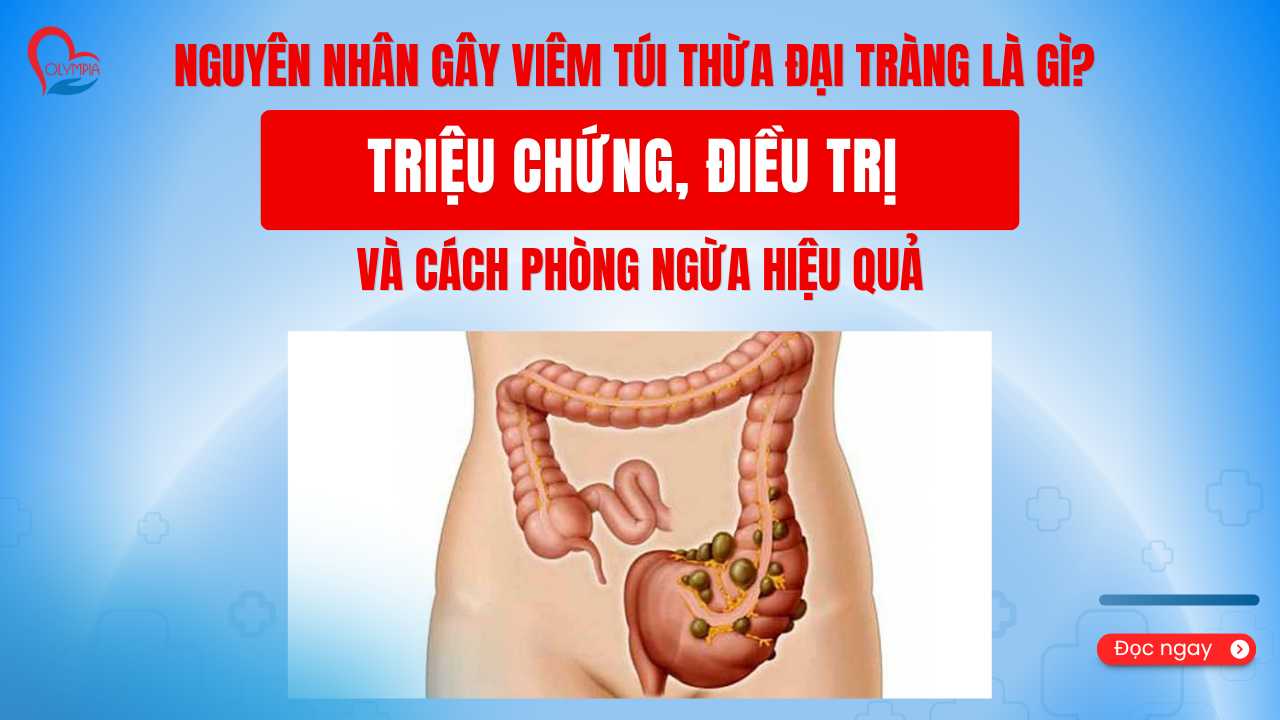 NGUYÊN NHÂN GÂY VIÊM TÚI THỪA ĐẠI TRÀNG LÀ GÌ TRIỆU CHỨNG, ĐIỀU TRỊ VÀ CÁCH PHÒNG NGỪA HIỆU QUẢ -phòng khám đa khoa olympia