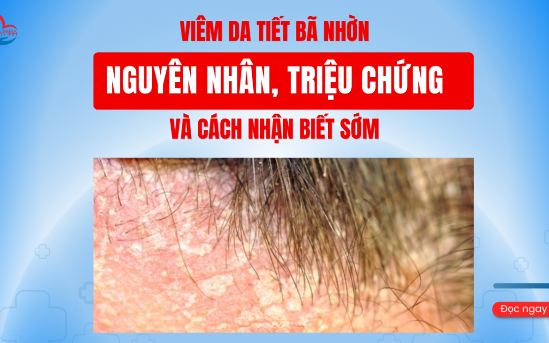 Viêm Da Tiết Bã Nhờn - Nguyên Nhân, Triệu Chứng Và Cách Nhận Biết Sớm- phòng khám đa khoa olympia