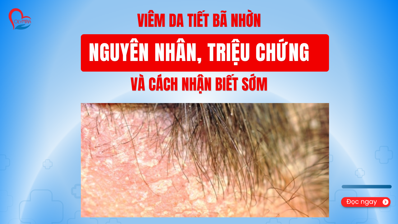 Viêm Da Tiết Bã Nhờn - Nguyên Nhân, Triệu Chứng Và Cách Nhận Biết Sớm- phòng khám đa khoa olympia