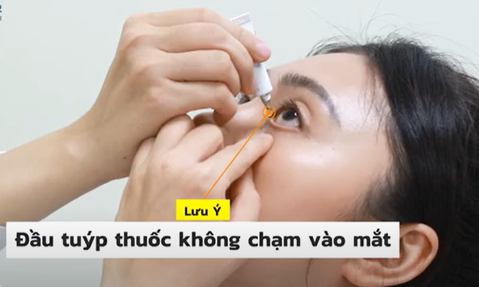 Giữ đầu tuýp thuốc gần mắt, không để đầu tuýp chạm vào bất kỳ phần nào của mắt hoặc lông mi.