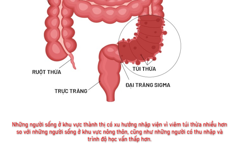 Viêm túi thừa