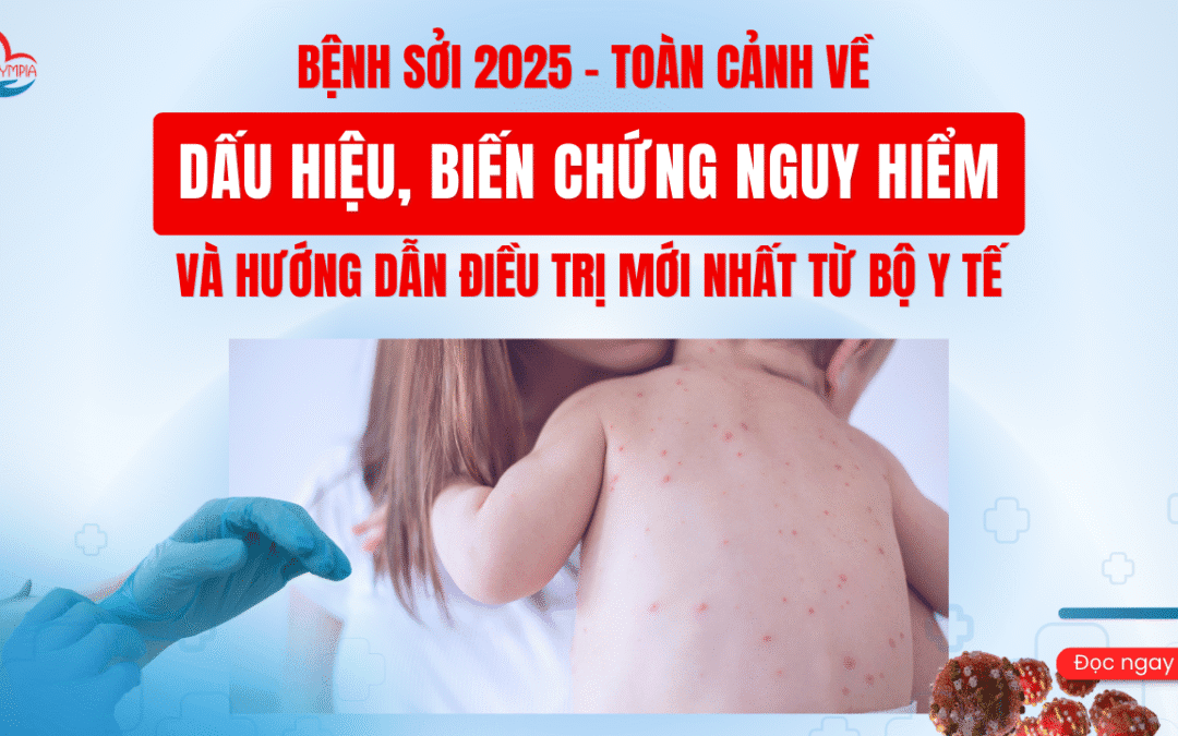 Bệnh Sởi 2025 – Toàn Cảnh Về Dấu Hiệu, Biến Chứng Nguy Hiểm và Hướng Dẫn Điều Trị Mới Nhất từ Bộ Y Tế
