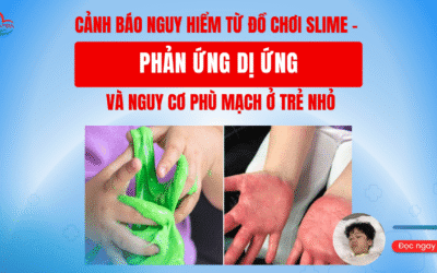 Cảnh báo nguy hiểm từ đồ chơi Slime – Phản ứng dị ứng và nguy cơ phù mạch ở trẻ nhỏ