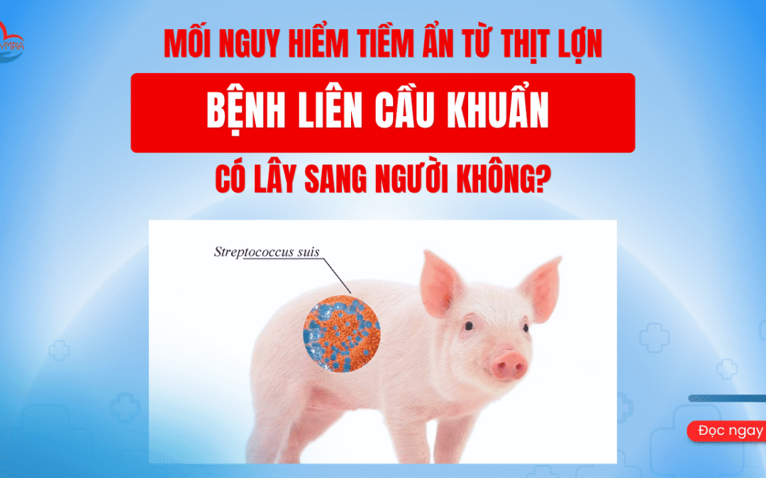 Mối nguy hiểm tiềm ẩn từ thịt lợn – Bệnh liên cầu khuẩn có lây sang người không?