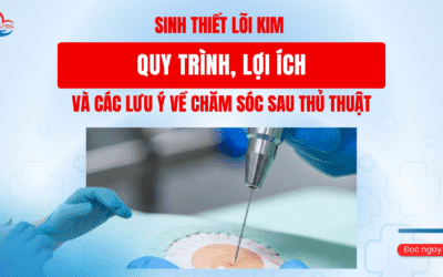 Sinh thiết lõi kim – Quy trình, lợi ích và các lưu ý về chăm sóc sau thủ thuật.