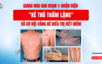 Giang Mai Giai Đoạn 1: Nhận Diện “Kẻ Thù Thầm Lặng” và Cơ Hội Vàng Để Điều Trị Dứt Điểm