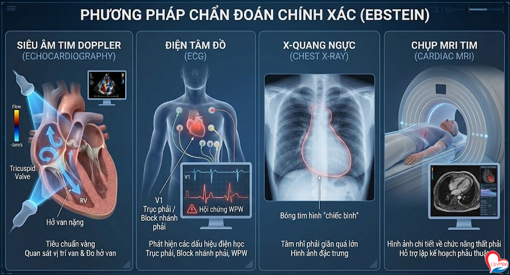 Phương pháp chẩn đoán chính xác để xác định bệnh Ebstein