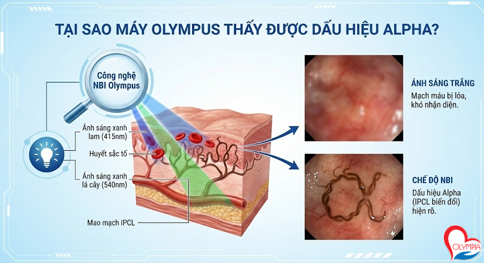 Tại sao máy Olympus thấy được dấu hiệu Alpha?