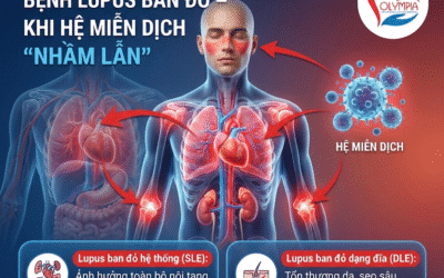 Bệnh lupus ban đỏ là bệnh gì? Dấu hiệu nhận biết và cập nhật điều trị mới nhất 2026