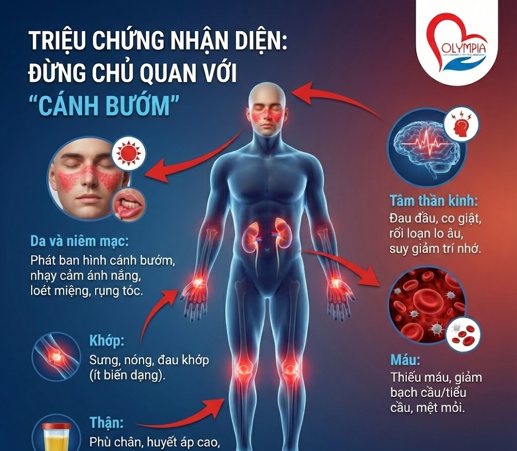 Triệu chứng nhận diện - Đừng chủ quan với "Cánh bướm"