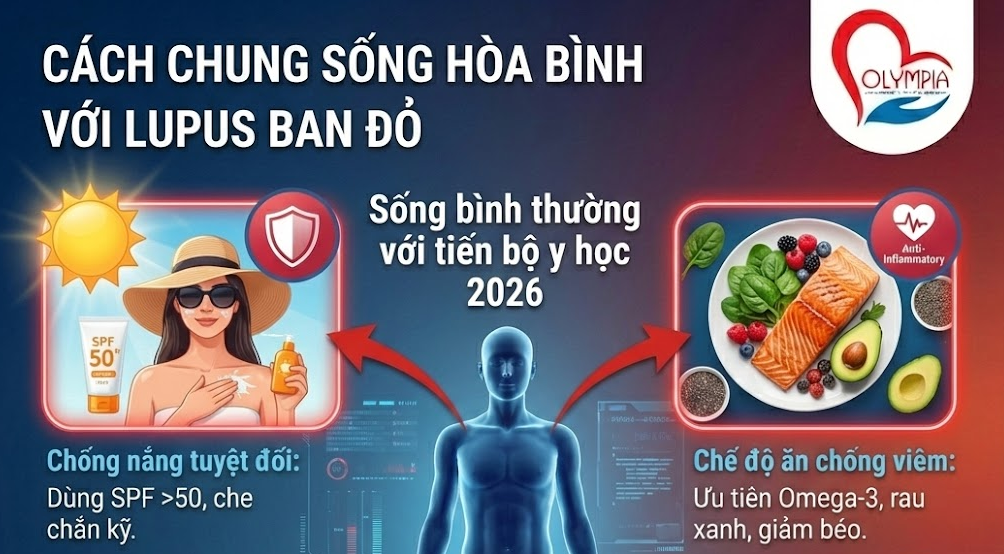 Cách chung sống hòa bình với Lupus ban đỏ