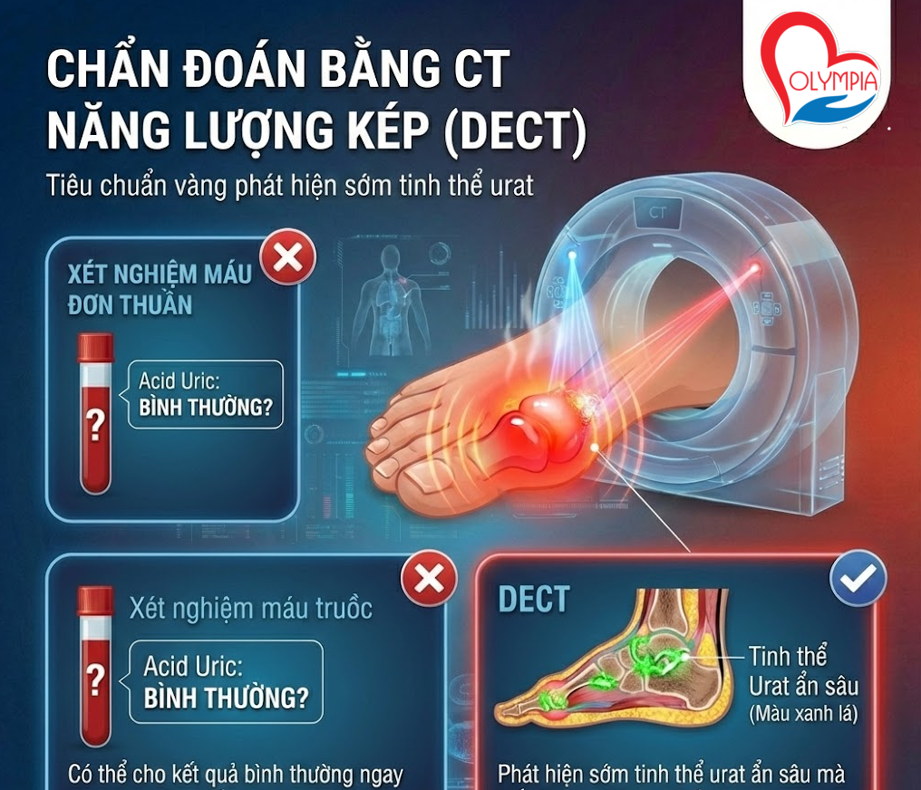 Chẩn đoán bằng CT năng lượng kép (DECT)