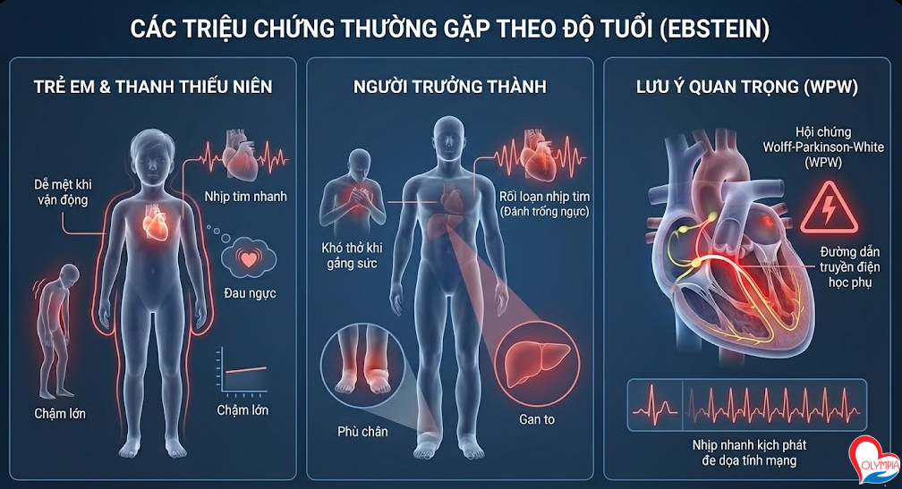 Biểu hiện của bệnh Ebstein rất đa dạng, tùy thuộc vào mức độ dị dạng của van ba lá.