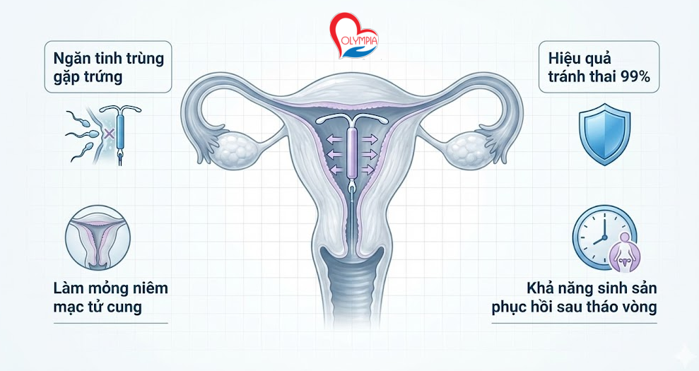 vòng tránh thai nội tiết (IUD nội tiết) - phòng khám đa khoa olympia