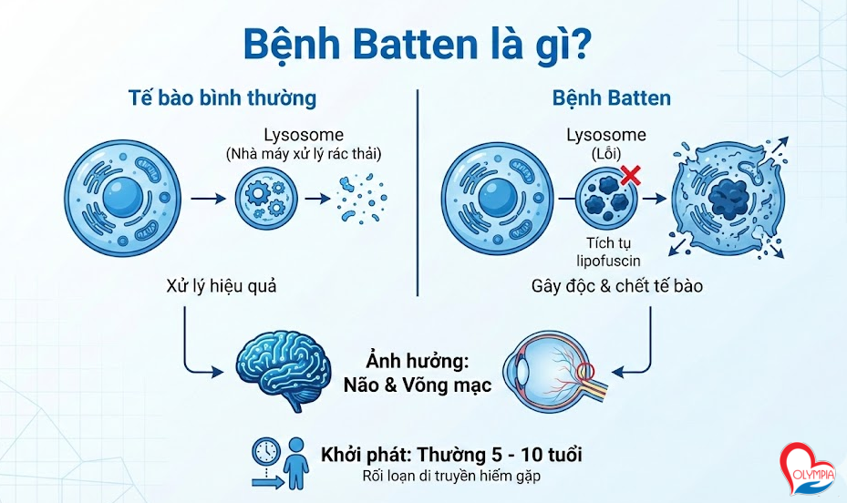 Bệnh Batten là gì?