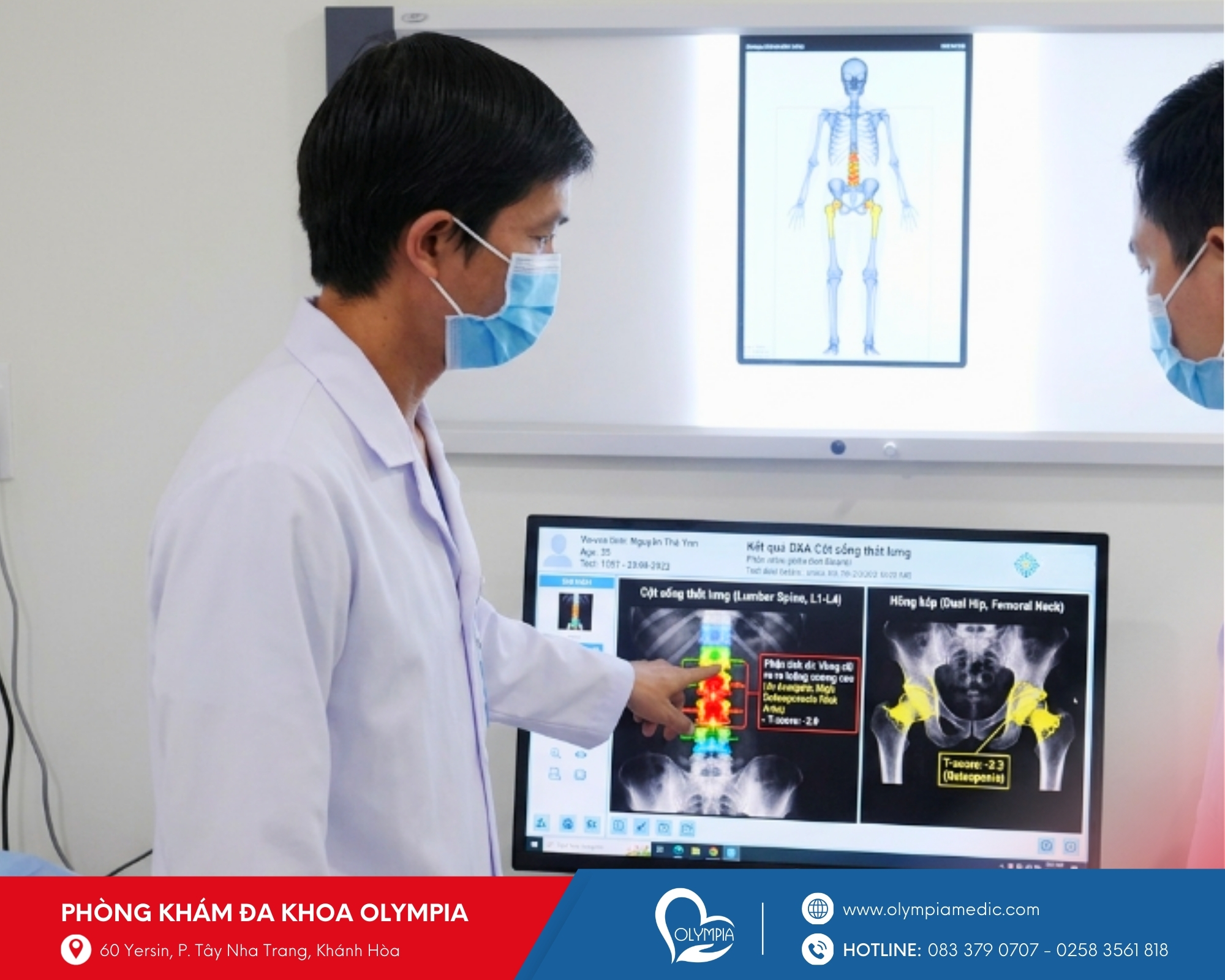 Đo mật độ xương bằng AI - bác sĩ Lộc - Phòng khám đa khoa olympia