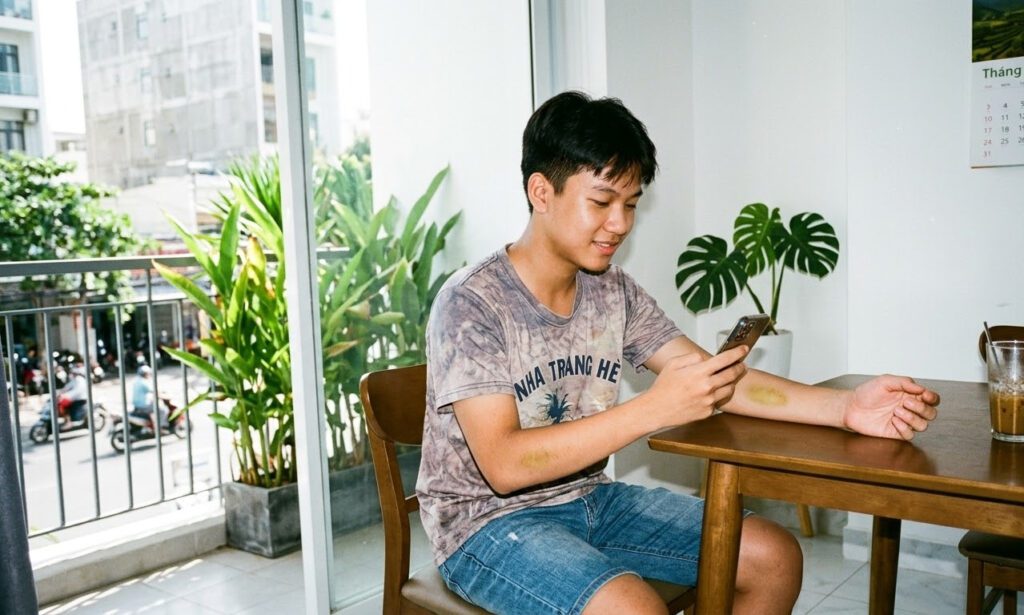 Hội chứng mất cảm giác đau (CIP)