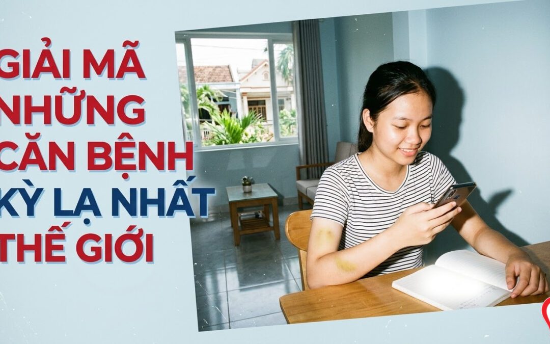 Giải Mã Những Căn Bệnh Kỳ Lạ Nhất Thế Giới – Bệnh Hiếm Gặp, Nguyên Nhân Và Cách Nhận Biết Từ Góc Độ Y Khoa