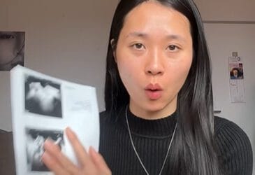 Bác sĩ Đức “bỏ quên” khối u 5cm suốt 3 năm, về Việt Nam 2 giờ tìm ra bệnh