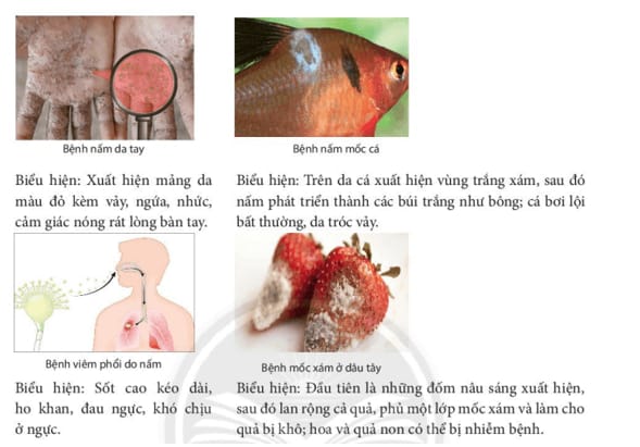 các bệnh do nấm gây ra