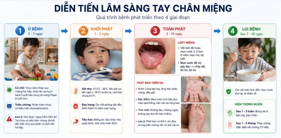 diễn tiến lâm sàng tay chân miệng