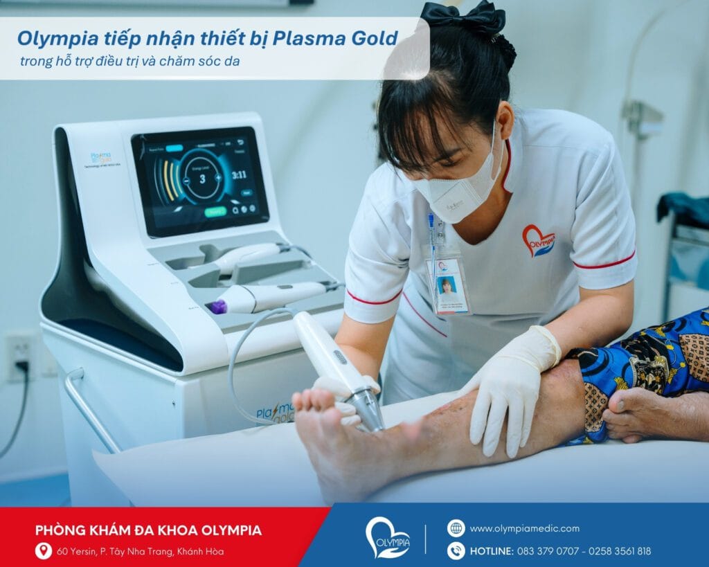 4 - olympia tiếp nhận thiết bị plasma gold